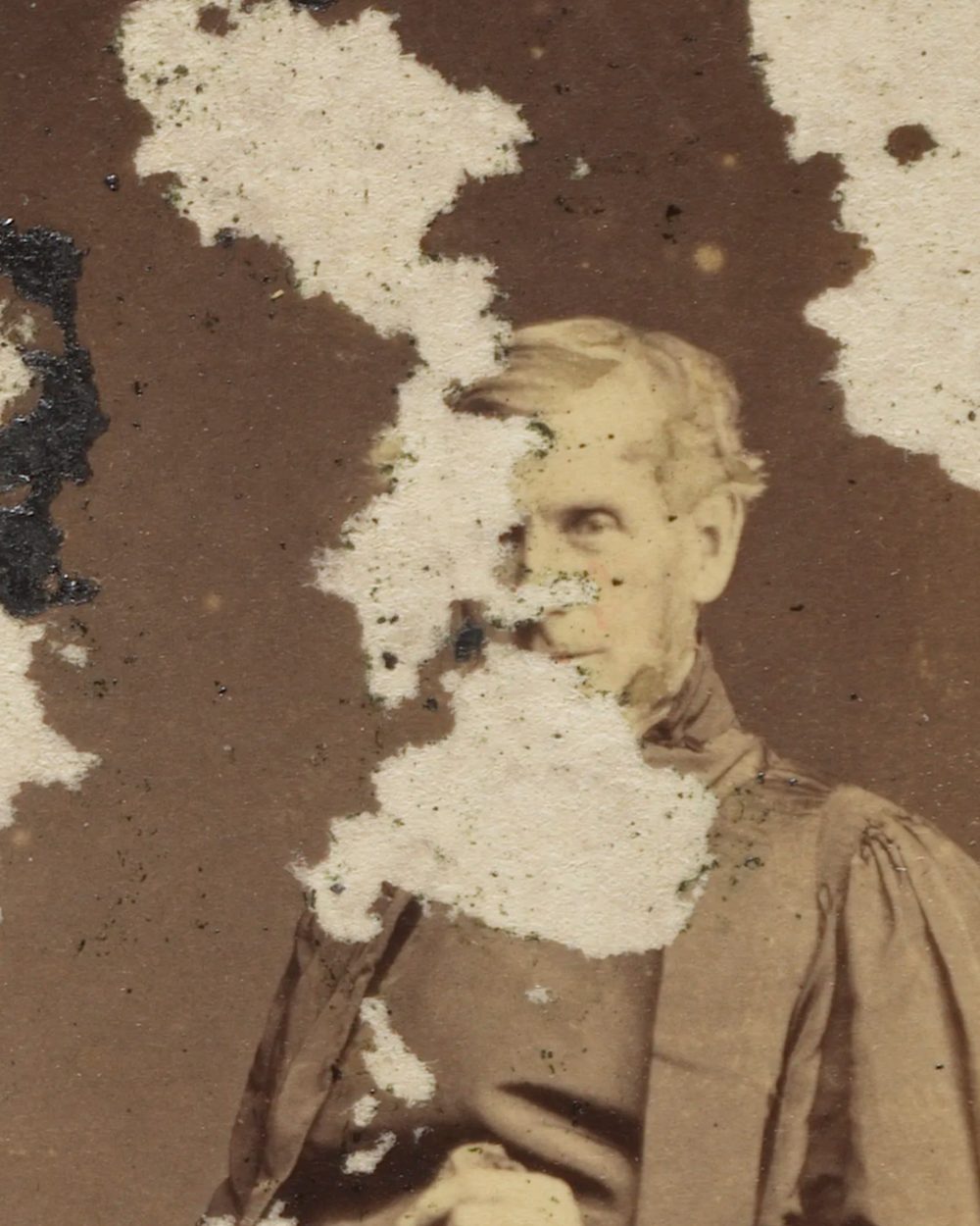An 1860s photograph of a seated clergyman with large white patches where the image has flaked away, including half of his face.